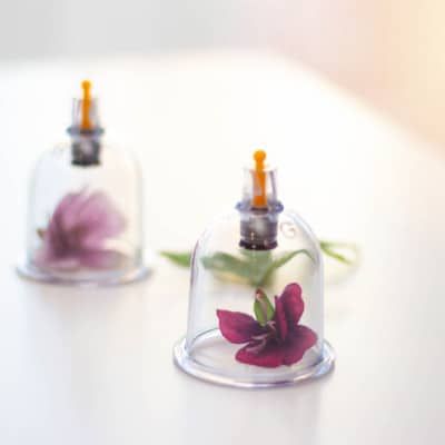 Hijama à Dijon
