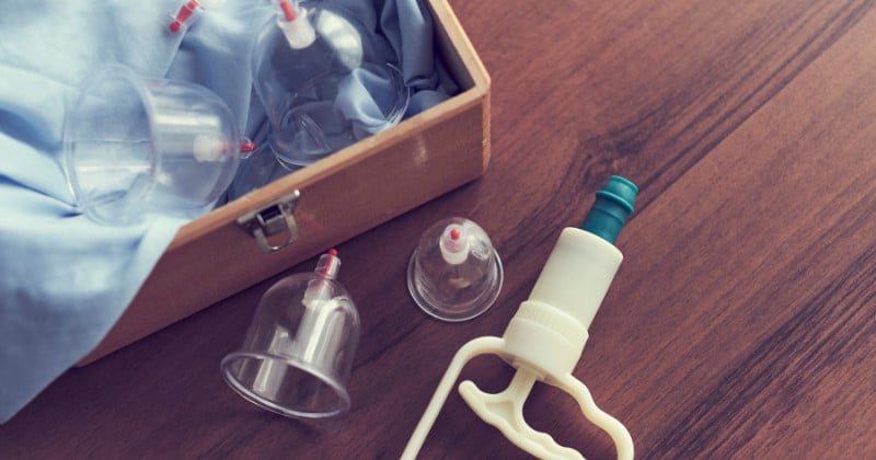 Hijama à Dijon